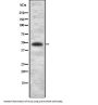 Acetylcholinesterase Collagenic Tail Peptide (COLQ) Antibody