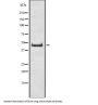 Double Homeobox Protein 4 (DUX4) Antibody