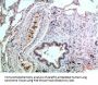 Mitogen-Activated Protein Kinase 14 (MAPK14) Antibody