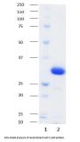 African Swine Fever Virus Phosphoprotein p30 (ASFV p30) Protein