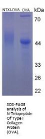 Human Cross Linked N-Telopeptide of Type I Collagen (NTXI) Peptide (OVA)