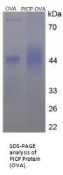 Human Procollagen Type I C-Terminal Propeptide (PICP) Peptide (OVA)