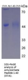 Human Amyloid Beta Peptide 1-40 (Ab1-40) Peptide (OVA)