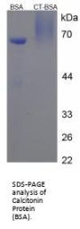 Human Calcitonin Gene Related Peptide 1 / CGRP1 (CALCA) Peptide (BSA)