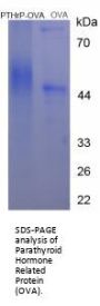 Human Parathyroid Hormone-Related Protein / PTHrP (PTHLH) Peptide (OVA)