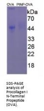 Human Procollagen Type I N-Terminal Propeptide (PINP) Peptide (OVA)