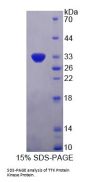 Human TTK Protein Kinase (TTK) Protein