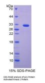 Human p21 Protein Activated Kinase 1 (PAK1) Protein