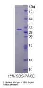 Human SRSF Protein Kinase 2 (SRPK2) Protein