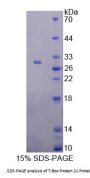 Human T-Box Transcription Factor TBX21 (TBX21) Protein