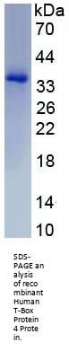Human T-Box Protein 4 (TBX4) Protein