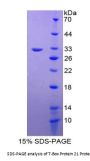 Rat T-Box Transcription Factor TBX21 (TBX21) Protein