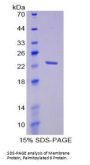 Human Membrane Protein, Palmitoylated 6 (MPP6) Protein