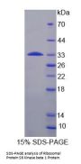Human Ribosomal Protein S6 Kinase Beta 1 (RPS6Kb1) Protein