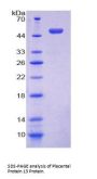 Human Placental Protein 13 (PP13) Protein