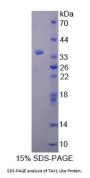Human TAK1 Like Protein (TAK1L) Protein