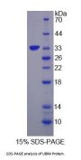 Human Ubiquitin Protein Ligase E3 Component N-Recognin 4 (UBR4) Protein