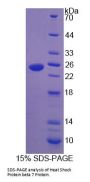 Human Heat Shock Protein Beta 7 (HSPb7) Protein