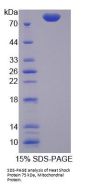 Human Heat Shock Protein 75 kDa , Mitochondrial (HSP75) Protein