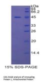 Rat Uncoupling Protein 1, Mitochondrial (UCP1) Protein