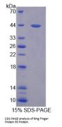 Human Ring Finger Protein 55 (RNF55) Protein