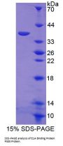 Human E1A Binding Protein P300 (EP300) Protein