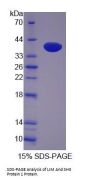 Human LIM And SH3 Protein 1 (LASP1) Protein
