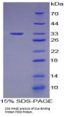 Mouse E1A Binding Protein P300 (EP300) Protein