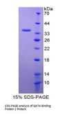 Human GATA Binding Protein 2 (GATA2) Protein