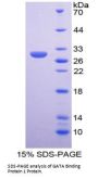 Human GATA Binding Protein 1 (GATA1) Protein