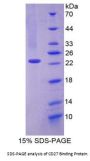 Human Apoptosis Regulatory Protein Siva / CD27BP (SIVA1) Protein