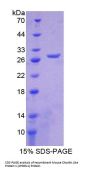 Mouse Chordin Like Protein 1 (CHRDL1) Protein