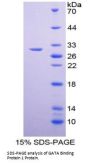 Mouse GATA Binding Protein 1 (GATA1) Protein