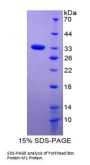 Rat Forkhead Box Protein M1 (FOXM1) Protein