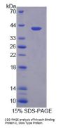 Mouse Myosin Binding Protein C, Slow Type (MYBPC1) Protein