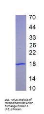 Rat Anion Exchange Protein 1 (AE1) Protein