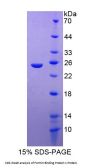 Human Formin Binding Protein 1 (FNBP1) Protein