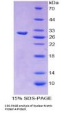 Human Nuclear Matrix Protein 4 (NMP4) Protein