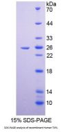 Human Tight Junction Protein ZO-1 (TJP1) Protein