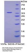 Human Retinol Binding Protein 3, Interstitial (RBP3) Protein