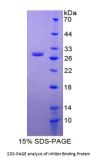 Human Inhibin Binding Protein (INHBP) Protein