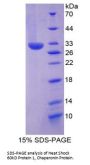 Mouse Heat Shock 60 kDa Protein 1, Chaperonin / HSP60 (HSPD1) Protein