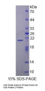 Human Heat Shock 40kDa Protein 2 (HSPF2) Protein