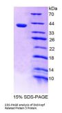 Mouse Dickkopf Related Protein 3 (DKK3) Protein