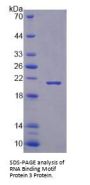 Human RNA Binding Motif Protein 3 (RBM3) Protein