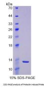 Rat Prolactin Induced Protein (PIP) Protein