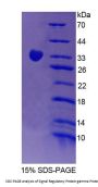 Human Signal Regulatory Protein Gamma (SIRPg) Protein