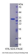 Human Calcyclin Binding Protein (CACYBP) Protein