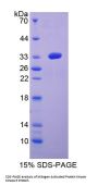 Human Mitogen Activated Protein Kinase Kinase 6 (MAP2K6) Protein