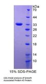 Human Neuromodulin (GAP43) Protein